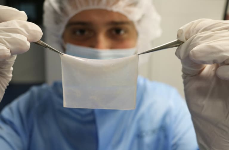 A Marseille, bientôt une première greffe de peau grâce à une imprimante 3D