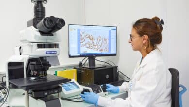 Ipsen rachète ImCheck